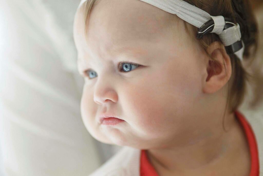 Ireland as a baby with her cochlear implants.