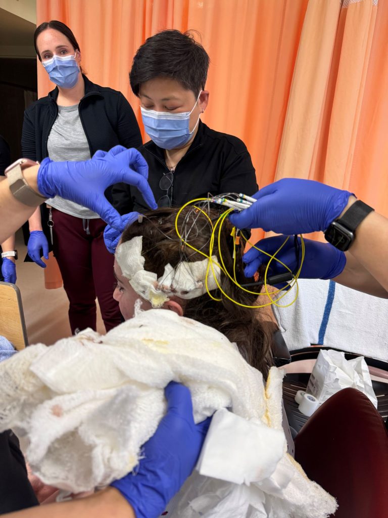 Cloé's health care team removing the head wrap after her sEEG surgery.